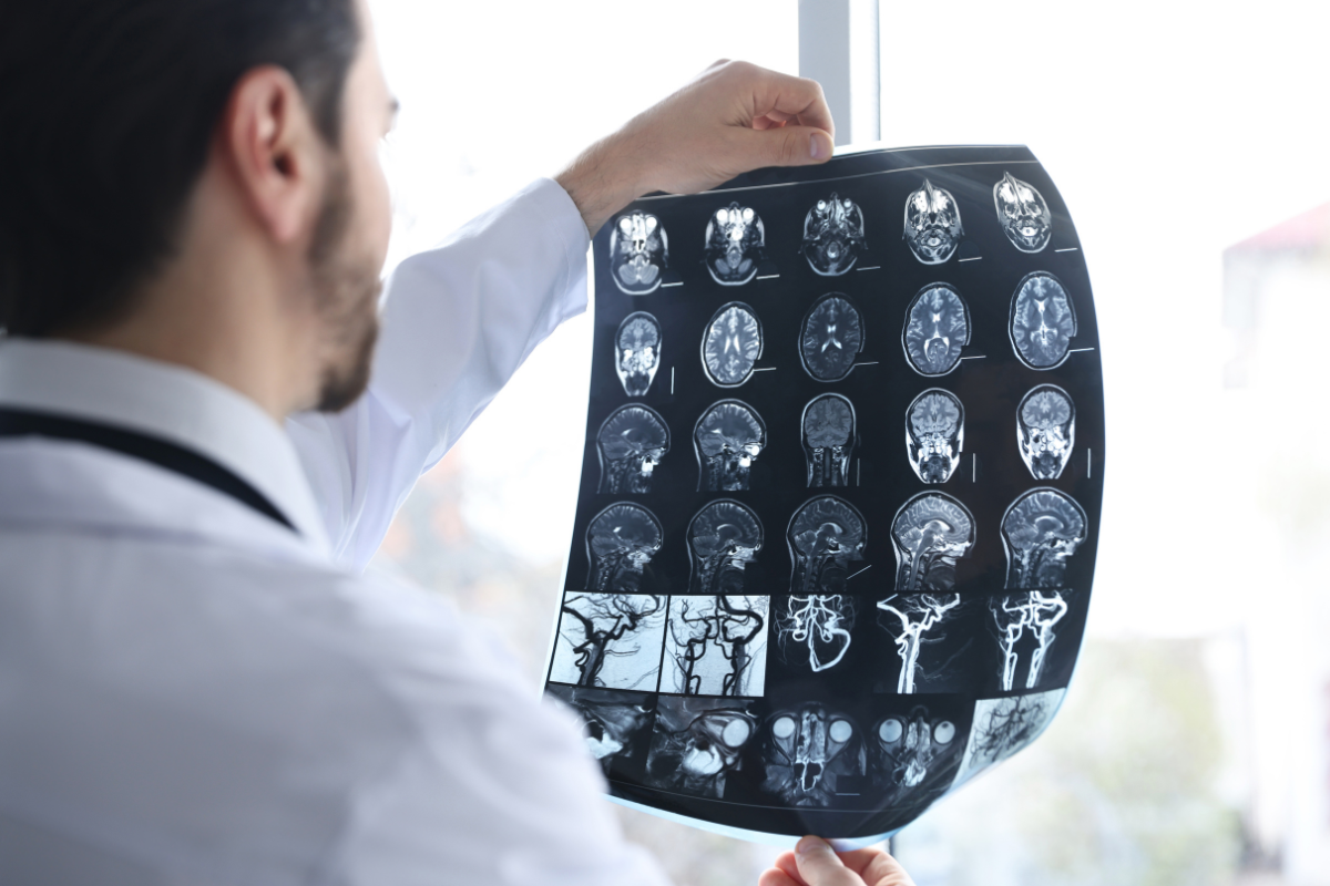 Graphic highlighting a $10 million case result for a medical malpractice brain injury